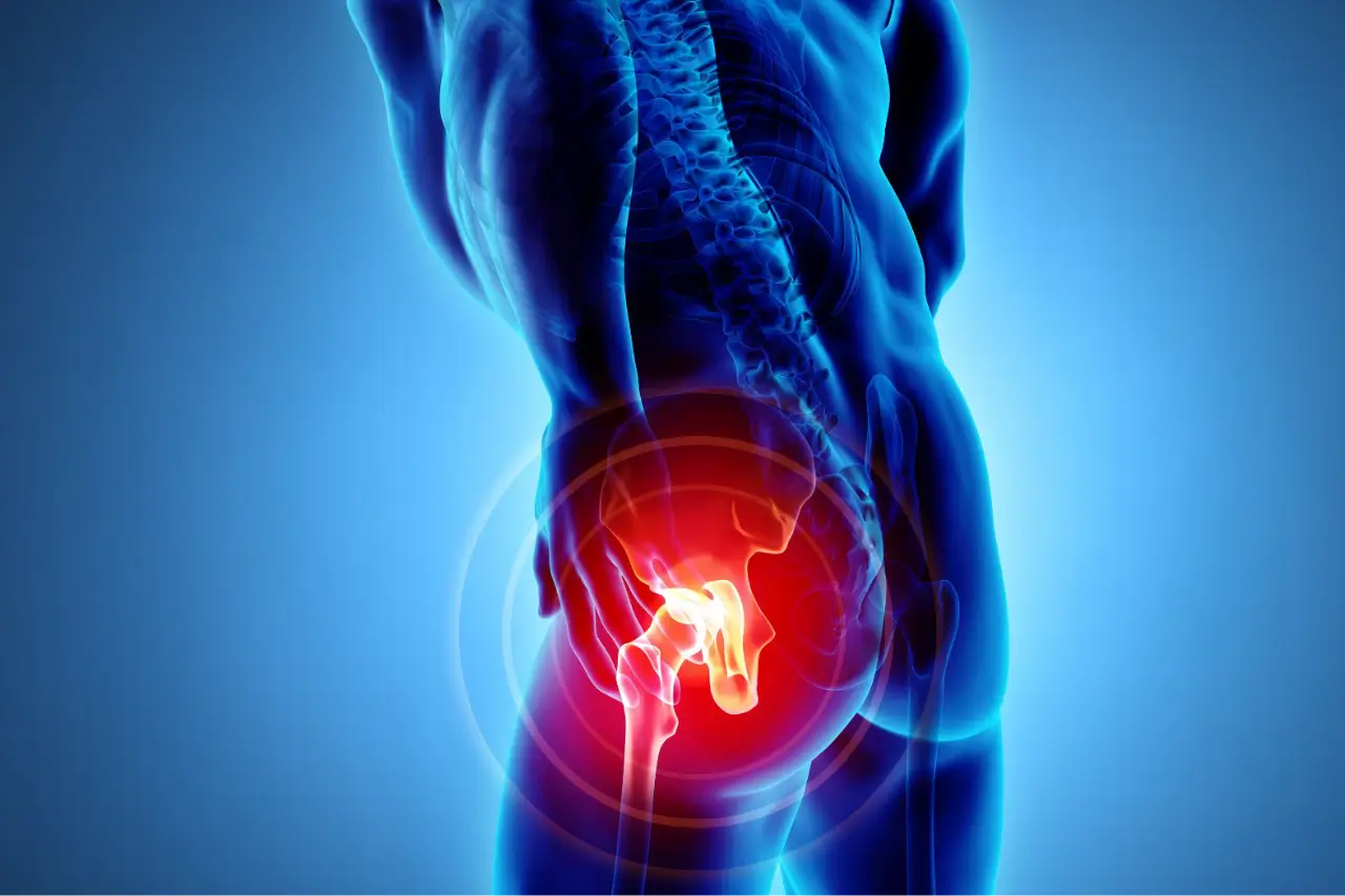 dor-no-quadril-tratamento