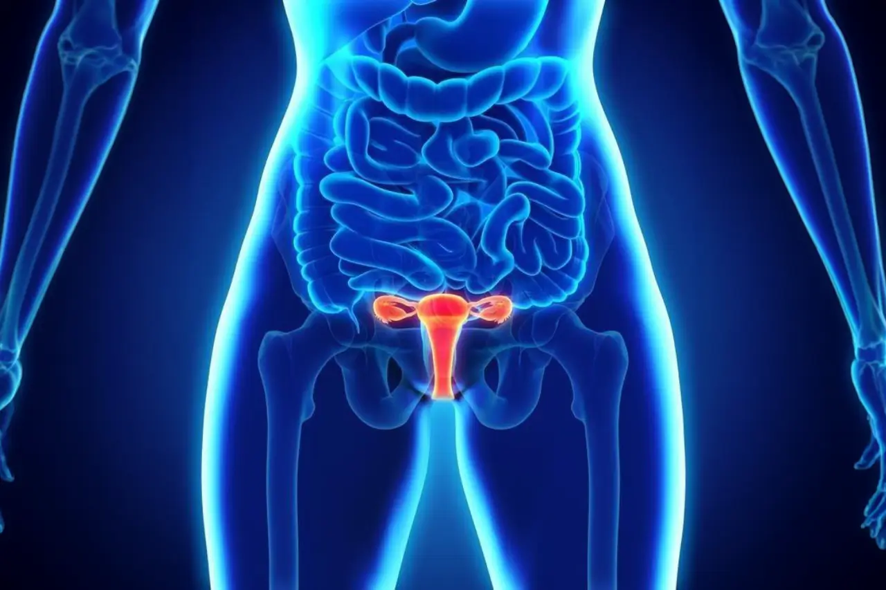 endometriose-tratamento